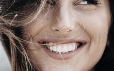 Sensational smiles patient