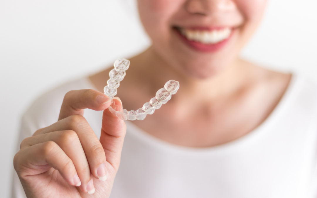 The Ultimate Review of the Best Clear Aligners